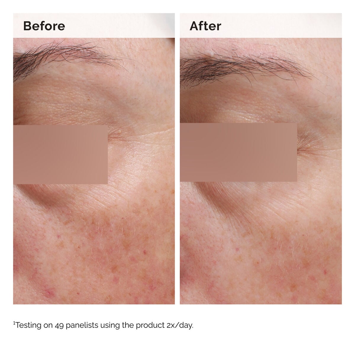 niacinamide-5-face-and-body-emulsion-p4 2024-08-23-ORD-Nia-5pct-Face-Body-B-A-Elasticity-Global-02-1x1.jpg
