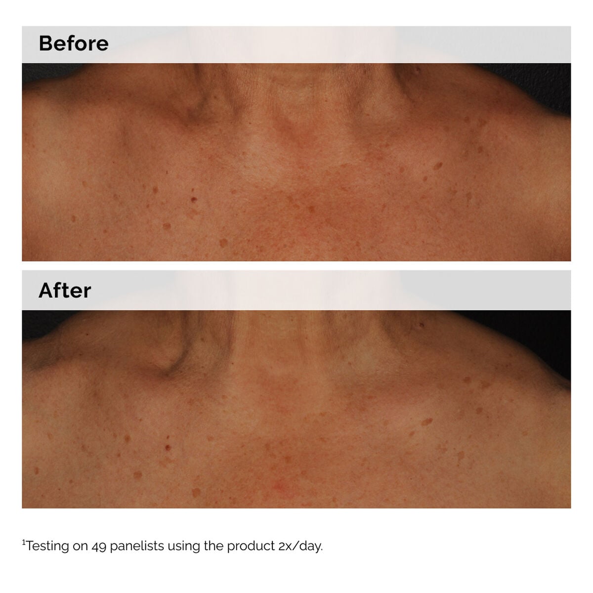 niacinamide-5-face-and-body-emulsion-p4 2024-08-23-ORD-Nia-5pct-Face-Body-B-A-Global-02-1x1.jpg