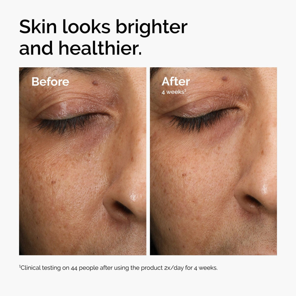 multi-antioxidant-radiance-serum-d5 ord-mars-before-after-healthy.jpg