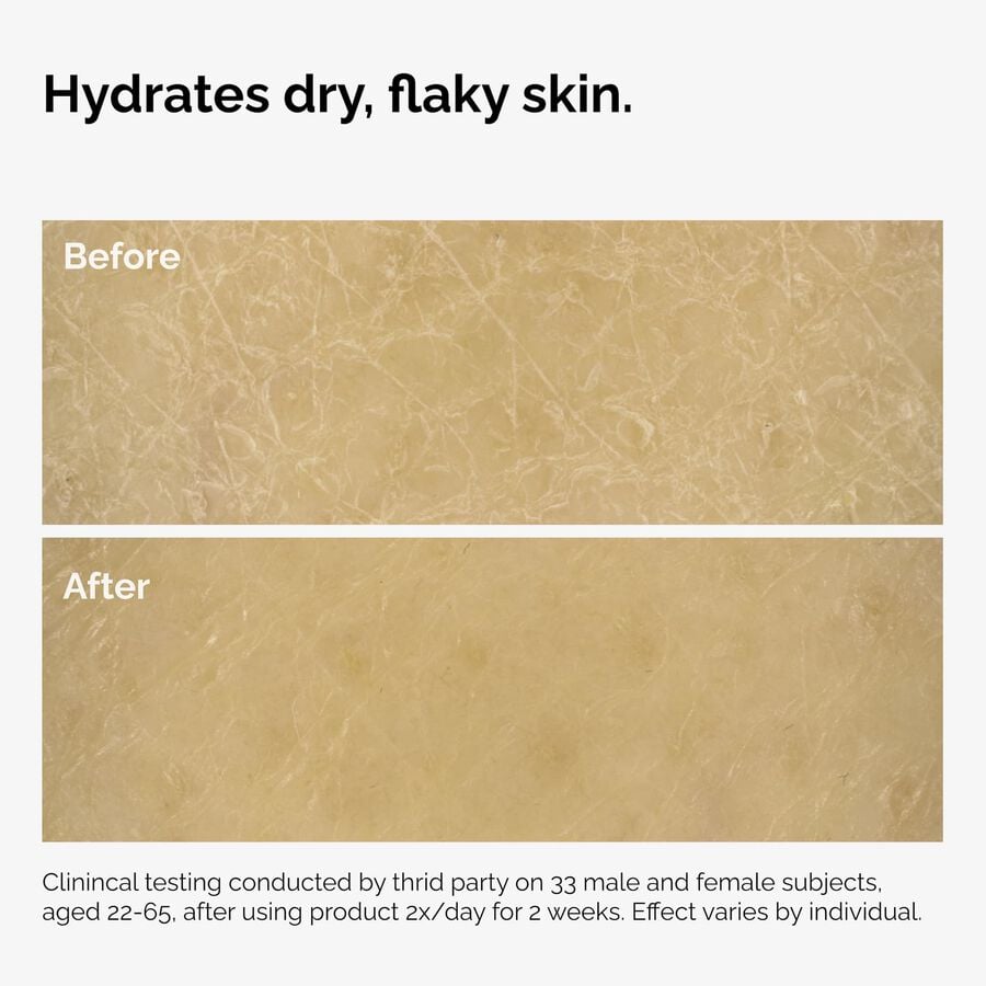 the-body-care-collection-a4 ord-natural-moisturizing-factors-inulin-body-before-after-graphic-02.jpg