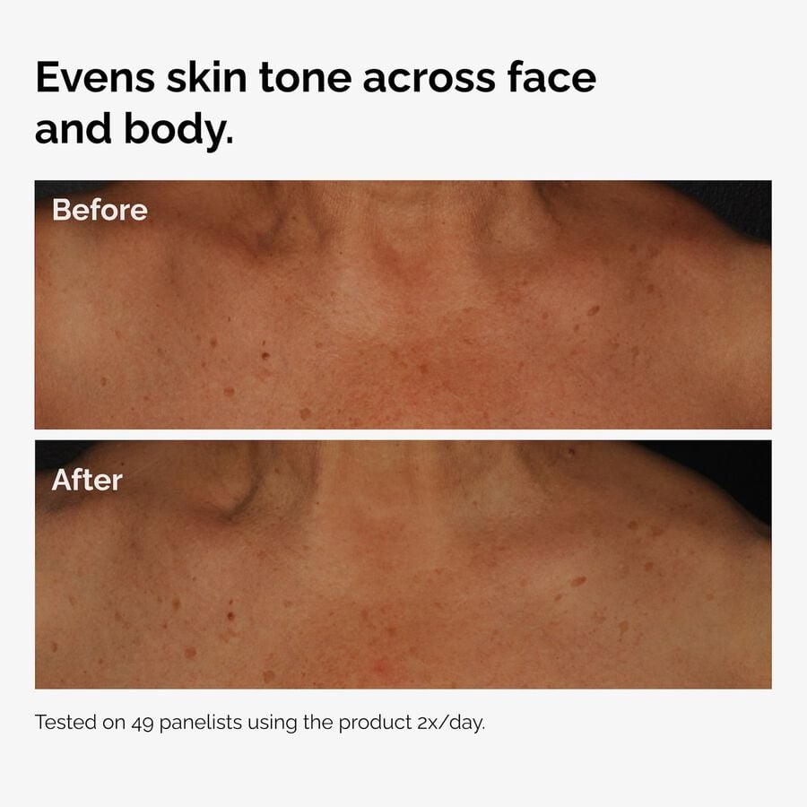 the-body-care-collection-a4 ord-niacinamide-face-body-serum-before-after-even-tone-graphic.jpg