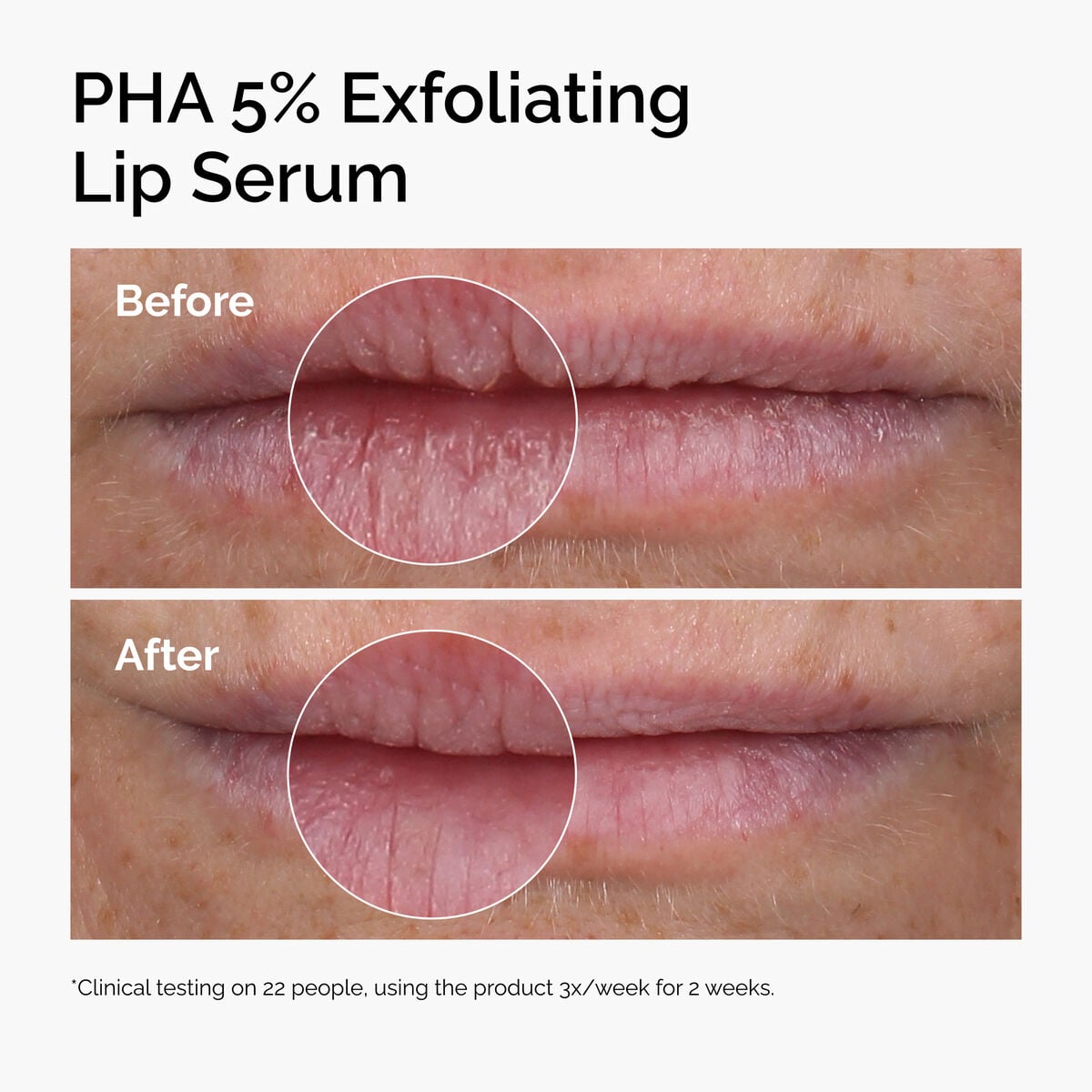 pha-5-exfoliating-lip-serum-y0 ord-pha-5pct-lip-exfoliating-serum-before-after.jpg