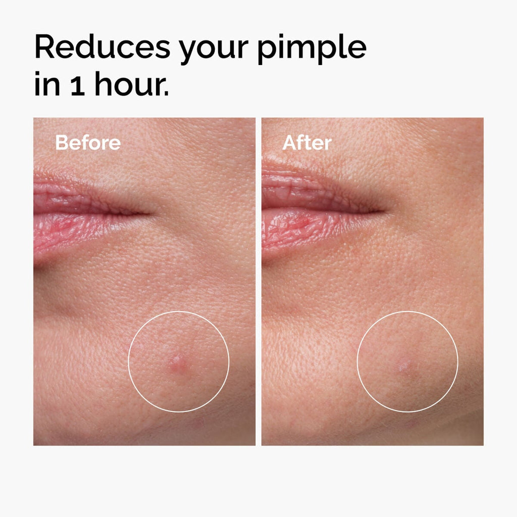 sulfur-10-powder-to-cream-concentrate-r0 ord-sulfur-10pct-powder-to-cream-concentrate-before-after-NA.jpg