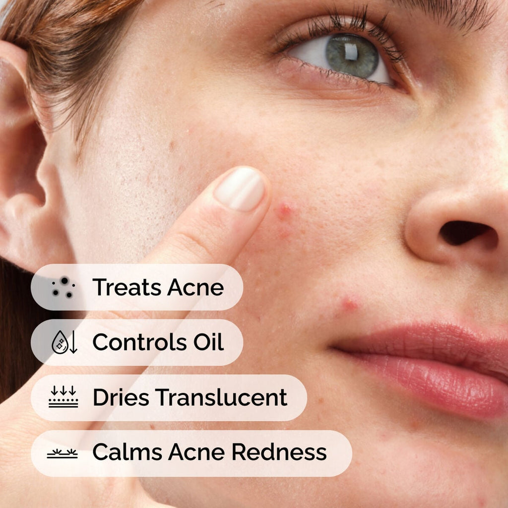 sulfur-10-powder-to-cream-concentrate-r0 ord-sulfur-10pct-powder-to-cream-concentrate-model-application-with-benefits-acne.jpg